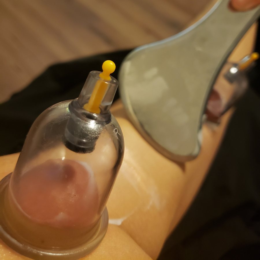 Dry Cupping with Dr. Brent Lockett